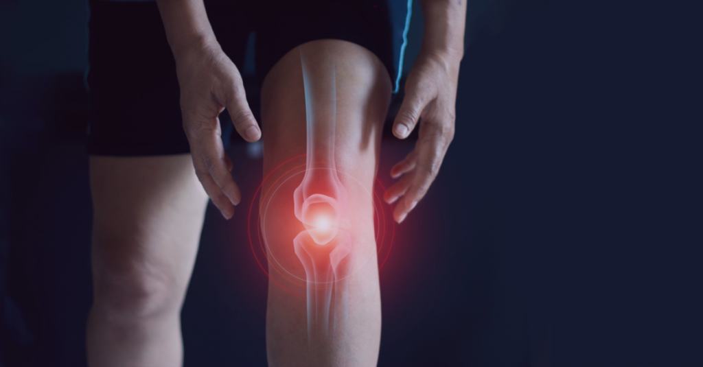 osteoarthritis treatment Brisbane